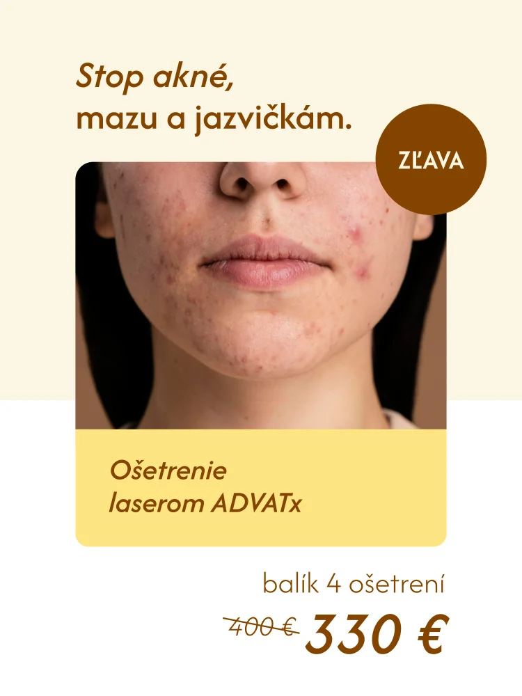 Dermatop – akcia Stop akné